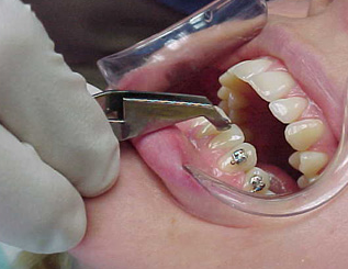 Mikro Diş Hekimliği